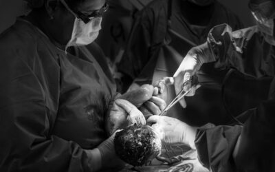 One in four births in England is now emergency caesarean, BBC analysis shows