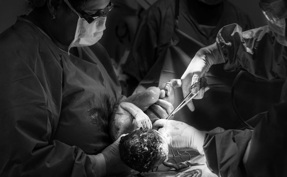 One in four births in England is now emergency caesarean, BBC analysis shows